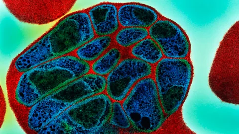 Some scientists think Plasmodium parasite strains can hypermutate to develop drug resistance more quickly (Science Photo Library)