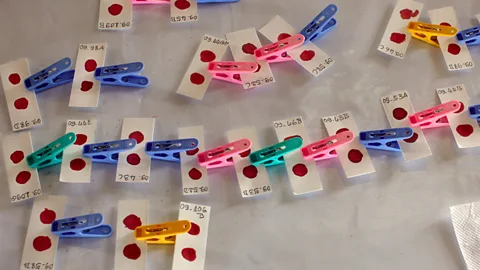 Blood samples dry during an intense malaria screening along the Thai-Cambodian border (Getty Images)