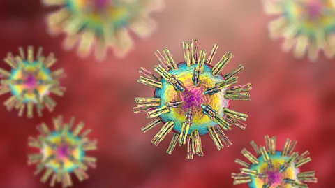 Getty Images As far back as the 1990s, a surprising number of people showed signs of HSV1 in their neural tissue (Credit: Getty Images)