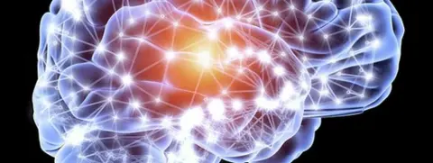 Science Photo Library Brain