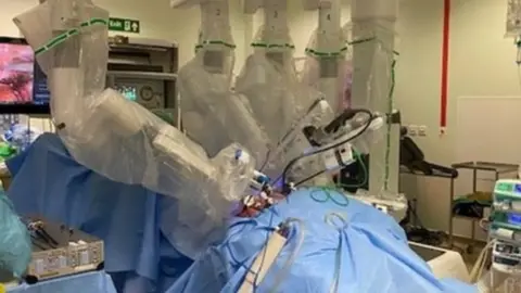 North Bristol NHS Trust Surgery under way in Bristol